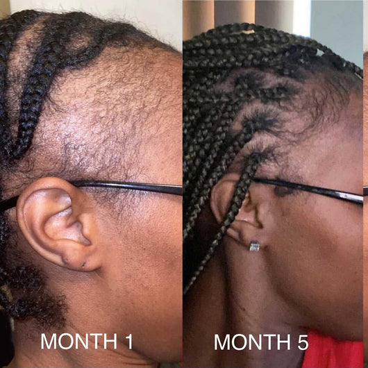 Beautiful Being™ Batana Rejuvenating Hair Growth Oil