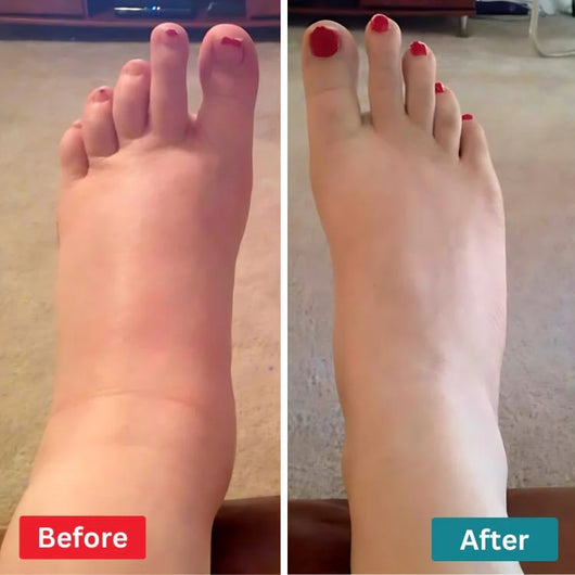 FeetRelief™ At-Home Foot Nerve Relief Device