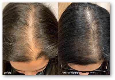 Beautiful Being™ Batana Rejuvenating Hair Growth Oil