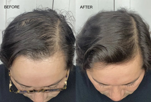 Beautiful Being™ Batana Rejuvenating Hair Growth Oil