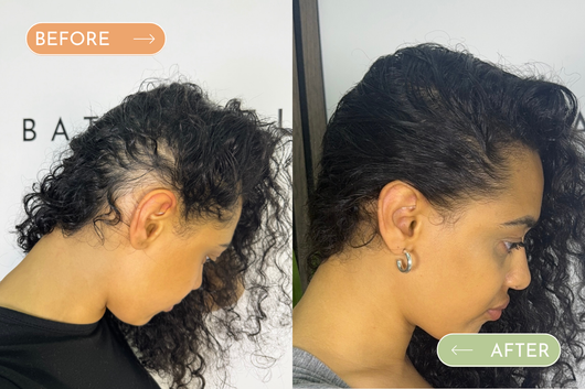 Beautiful Being™ Batana Rejuvenating Hair Growth Oil
